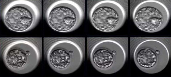 子宫内膜厚度与怀孕率代生哪家靠谱公立供卵试管代怀知识